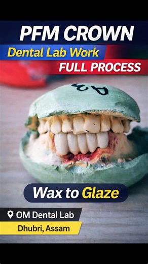 PFM Crown Process in 30 Seconds | Dental Lab Work