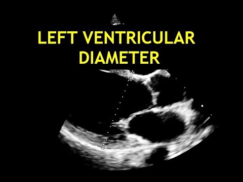How to measure the LEFT VENTRICULAR DIAMETER: Echocardiography!