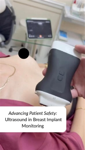 Cosmetic Courses on Instagram: "🩺 Our surgeon, Mr Ali Arnaout, demonstrates how he uses the Clarius ultrasound to perform breast implant health check-ups — ensuring patient safety and peace of mind every step of the way. Want to enhance your own skills with ultrasound? Join our Facial Anatomy & Ultrasound Masterclass at Cosmetic Courses, Buckinghamshire: - Friday 21st November – Ultrasound Level 1 -Saturday 22nd November – Ultrasound Level 2 -One Day Course Price: £995 + VAT Plus, don’t miss ou