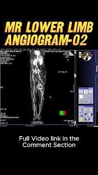 MR Peripheral (Lower Limb) Angiogram -02 | #mri #radtech #radiology#radiographer #medicalimaging