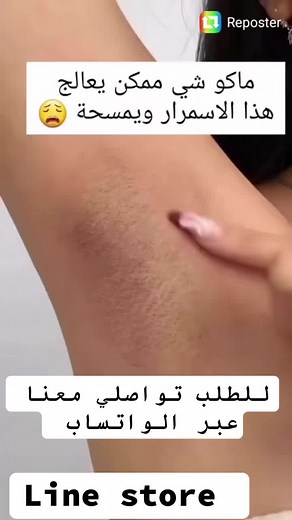 جل كريم snow white الشهير ✅ 🩷 من افضل المنتجات للمناطق الداكنة في الوجه والجسم وخصوصا المناطق الحساسة والابط والركبتين 🌸 يساعد على تفتيح البشرة - ومنع انتاج الميلانين والحفاظ على البشرة ناعمة ايضاً يعطي رطوبة للجلد دون تهيّج ❤️تفتيح اكثر من 3 درجات ونتائج ملحوظة 😍 للطلب والاستفسار عبر رسائل الواتساب التوصيل لجميع مناطق الضفه والقدس والداخل