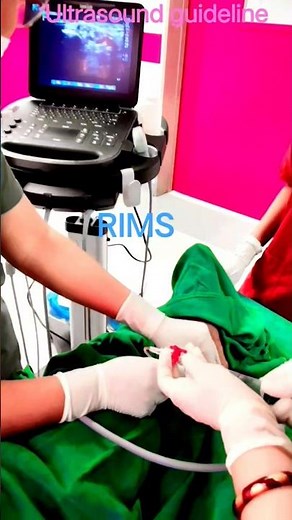ankle block #ultrasound guideline #Rimshospitalranchi #short video vairal #anaesthesia