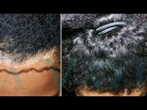 Umusatsi ukura ureba ibanga ryo kugira umusatsi mwiza wa naturel