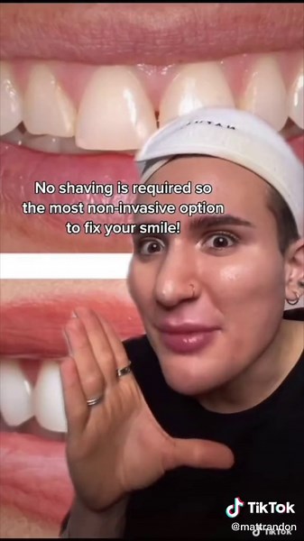 Achieve the Perfect Smile with These Beauty Tips!