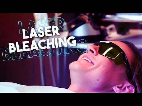 Laser Teeth Whitening at Fort Bend Dental
