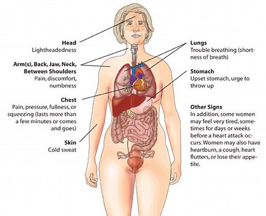 Myocardial Infarction Treatment