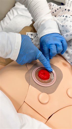 Kristine Tuttle | Ostomy pouching made simple!👝⁠ ⁠ ➡️ The goal is to keep skin healthy while creating a secure seal for the pouch⁠ 🔑 Prepare, protect, and... | Instagram