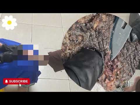 🔥 Severe Jigger Invasion – Hidden Layers of Damage Revealed! #DG193