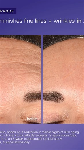 𝗘𝘅𝗼𝘀𝗼𝗺𝗲𝘀 𝗙𝗮𝗰𝗶𝗮𝗹 𝗧𝗿𝗲𝗮𝘁𝗺𝗲𝗻𝘁 𝗶𝘀 𝗰𝗼𝗺𝗶𝗻𝗴 𝘀𝗼𝗼𝗻!⁣ ⁣ Dermalogica Exo Booster is the first bacterial exosome system in regenerative skin care. Backed by global clinical studies, these vegan exosomes are designed to accelerate post-procedure results after treatments like laser resurfacing, microneedling, dermaplane treatment and chemical peels. Exo Booster is clinically proven to improve skin texture, tone, and resilience.⁣ ⁣ Recommended for: All skin types⁣ ⁣ Key Benefi