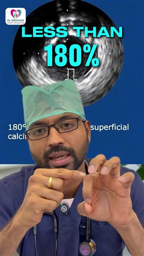 IVUS Explained: How Doctors Detect Hidden Heart Blockages | Advanced Heart Scan Technology