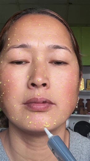 Effective Anti-Aging Solutions for Wrinkles