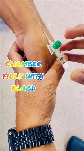 18G IV Line #intravenous #ivline #ivfluids #anesthesia #emergency