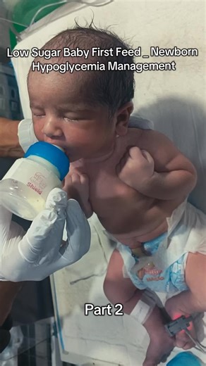 Low Sugar Baby First Feed _ Newborn Hypoglycemia Management _neonatologist _nicu _babycare #newborn #preterm #babycare #usa #unfreezmyaccount
