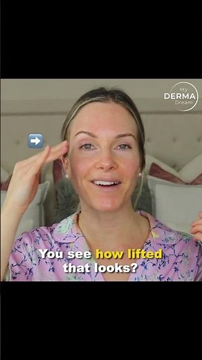 My Derma Dream's Microsculpt Exposed: The Shocking Before & After
