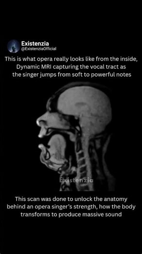 The Hidden Mechanics of Opera Singing, Captured by MRI