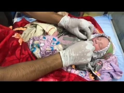 Observation of a Newborn in the NICU: Initial Assessment and Care Practices