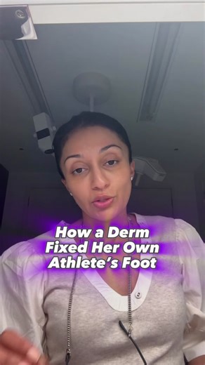 A Derm’s Worst Nightmare | #onychomycosis Also the only time youll ever see me post my before and afters #fluconazole #ketoconazole #fungusamongus