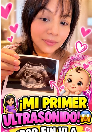 🤰😱 ¡MI PRIMER ULTRASONIDO! 🥹❤️ ¡POR FIN VI A MI BEBÉ! 👶💕 ¡ESTOY EMBARAZADÍSIMA! 💥😭❤️ #MiPrimerUltrasonido #EstoyEmbarazada #EmbarazadaEnEstadosUnidos #MiVidaEnUSA #VlogDiario