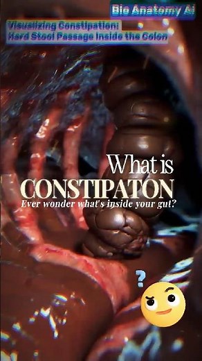 Inside the Colon How Constipation Progresses#3danimation🤯#digestivesystem#constitution#shorts#viral