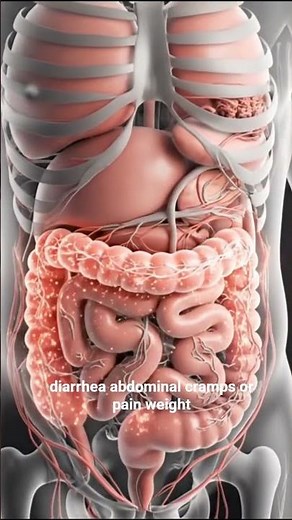 Crohn’s Disease Explained in 30 Seconds | 3D Medical Animation.#CrohnsDisease #IBD #MedicalAnimation