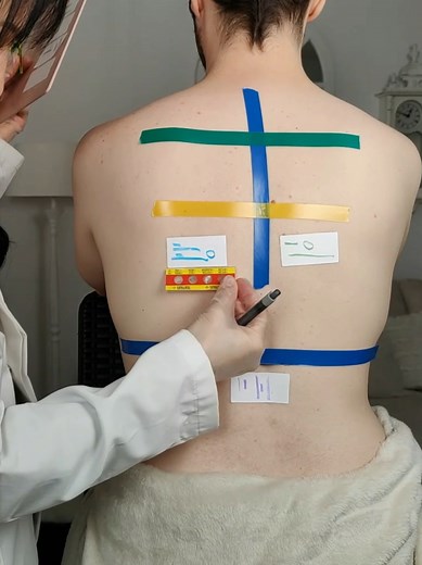 Skin Analysis for Allergy Detection and Care