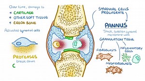 2.6K views · 128 reactions | Rheumatoid arthritis | Davidson's Principles and Practice of Medicine | Facebook