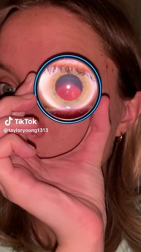 At-Home Dilated Eye Exams Explained