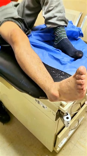 Dr. Tom Walters, DPT, OCS on Instagram: "💥𝐀𝐧𝐤𝐥𝐞 𝐉𝐨𝐢𝐧𝐭 𝐑𝐞𝐝𝐮𝐜𝐭𝐢𝐨𝐧💥 —— 👉Here is a somewhat graphic video from @dr_maximo_ that shows the reduction of an ankle joint dislocation. 📚Ankle joint dislocations involve situations where a trauma leads to an abnormal separation of the talocrural joint (articulation between tibia, fibula and talus). 🔎In most cases (99%), ankle dislocations are accompanied by a fracture, but in rare cases they can exist in isolation. ✅If you’ve suffere