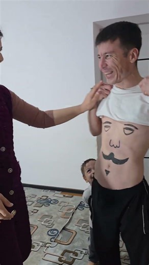 Treatment for a hand burn 🤣 #funny #comed#comics #short #shorts