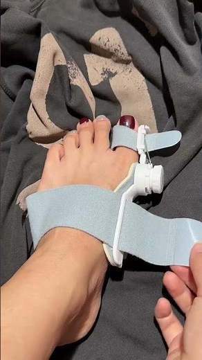 Foot Care Toe Alignment Strap 👣 | Daily Wear, Visible Results