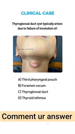 CLINICAL CASE 99| SURGERY| ANATOMY| ENT| MEDICINE|NEETPG| FMGE