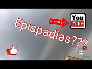 EPISPADIAS (CHILD HEALTH NURSING)