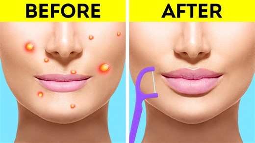 57K views · 340 reactions | Secret beauty hacks to look flawless || Amazing beauty and makeup hacks for you: | You're Gorgeous | Facebook