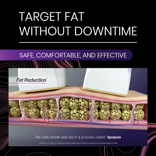 Venus Bliss MAX™ – The 3-in-1 Advanced System for Complete Body Transformation Combining diode laser, Multi-Polar RF with PEMF, and muscle stimulation, Bliss MAX™ reduces fat, smooths cellulite, and conditions muscles, offering a full-spectrum solution in one device. Drive patient satisfaction with proven results by discovering Bliss MAX™ now. Contact our sales team now: https://www.venus.ai/contact-us | Venus Aesthetic Intelligence