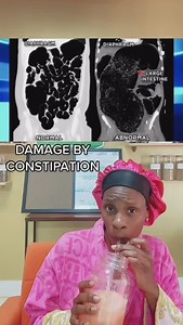 8.1K views · 91 comments | read  if your gut/colon is clogged, your...