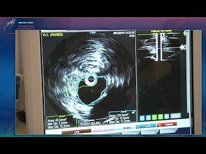 Venogram, IVUS, Venoplasty/Stenting - LINC 2018 LC 6 Sinai_Ting - Tue 2:08pm
