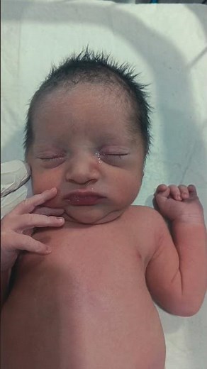 Preterm Newborn Initial Assessment in NICU | Nursing Skills Video #baby