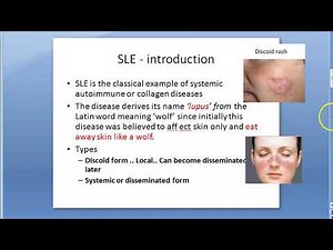 Pathology 078 a Systemic Lupus Erythematosus SLE discoid anti ANA dsDNA smith LE cell Libman