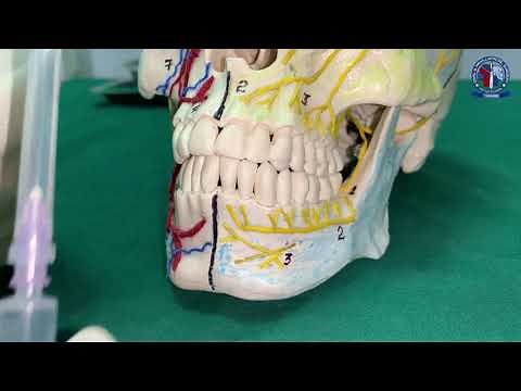 Supra periosteal injection