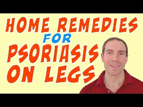 Home Remedies For Psoriasis On Legs - Remedy Psoriasis on your Legs