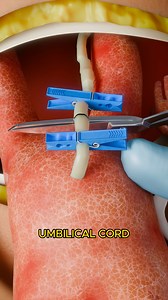 How C Section Surgery Is Performed 🤔 [KwseB2QtWa4] | Reels Media