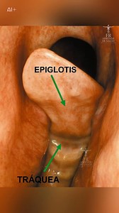 La epiglotis es una pequeña válvula que cierra la entrada de la tráquea cada vez que tragas, evitando que los alimentos pasen a los pulmones. En medicina se considera esencial para proteger la vía respiratoria. Educar es salvar vidas. Comparte este mensaje. #epiglotis #víasrespiratorias #anatomía #medicina #salud #cuerpohumano #epiglottis #airway #health #medicine #biology | Aprende de salud , learn about health
