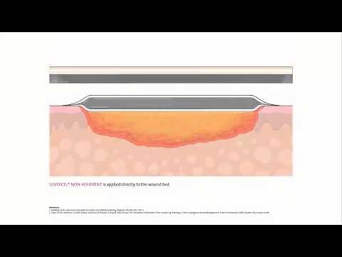 SILVERCEL™ NON-ADHERENT Antimicrobial Alginate Dressing with EasyLIFT™ Precision Film Technology