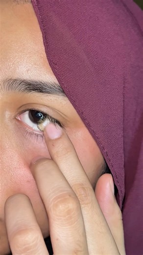 How to remove contact lens #contactlenses #hazel #freshlook