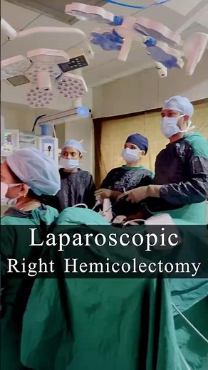 Laparoscopic Right Hemicolectomy