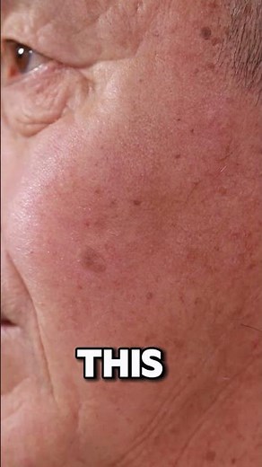 The Truth About The Disney Rash#DisneyRash#TheTruthAboutDisneyRash#HealthAwareness#SkinHealth
