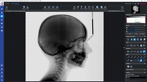 How to – Process 2D images in Planmeca Romexis