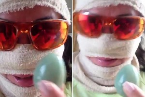 Lisa Appleton shows off her 'vagina egg' as she gives fans a tour of new caravan home with her face bandaged up after £10,000 plastic surgery
