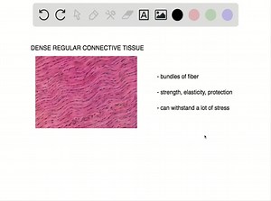 Ligaments connect bones together and withstand a lot of stress. What type of connective tissue should you expect ligaments to contain? a. areolar tissue b. adipose tissue c. dense regular connective tissue d. dense irregular connective tissue | Numerade