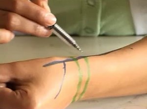 Extensor Retinaculum